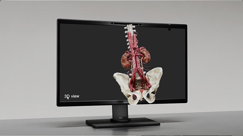 Video- BARCO Eonis 3D Display 